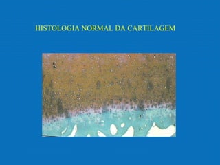 HISTOLOGIA NORMAL DA CARTILAGEM
 