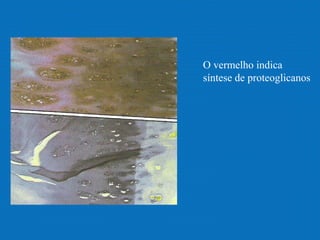 O vermelho indica
síntese de proteoglicanos
 