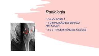 Radiologia
• RX DO CASO 1
• 1-DIMINUIÇÃO DO ESPAÇO
ARTICULAR
• 2 E 3 -PROEMINÊNCIAS ÓSSEAS
 