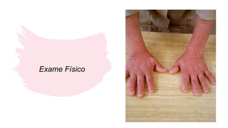 Exame Físico
 