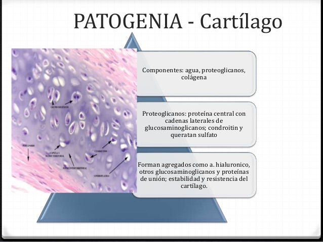 Osteoartritis