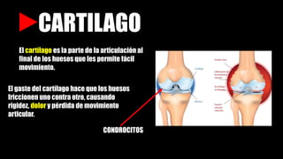 CARTILAGO
El cartílago es la parte de la articulación al
final de los huesos que les permite fácil
movimiento.
El gaste del cartílago hace que los huesos
friccionen uno contra otro, causando
rigidez, dolor y pérdida de movimiento
articular.
CONDROCITOS
 