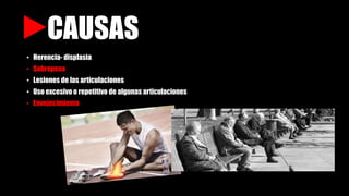 CAUSAS
• Herencia- displasia
• Sobrepeso
• Lesiones de las articulaciones
• Uso excesivo o repetitivo de algunas articulaciones
• Envejecimiento
 