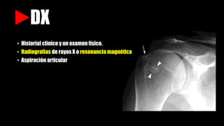 DX
• Historial clínico y un examen físico.
• Radiografías de rayos X o resonancia magnética
• Aspiración articular
 