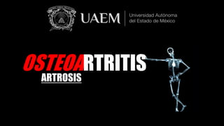 OSTEOARTRITIS
ARTROSIS
 