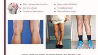 ■
■
■
■
■
■
Sinusas, K. Osteoarthritis: Diagnosis and treatment. American Family Physician 2012: 85:1
 