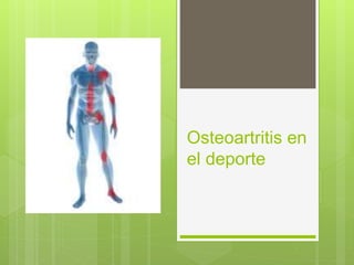 Osteoartritis en
el deporte
 