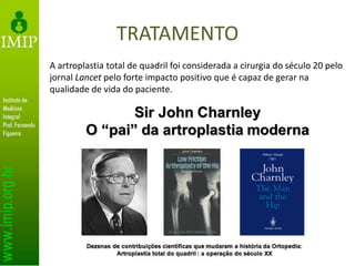 TRATAMENTO
A artroplastia total de quadril foi considerada a cirurgia do século 20 pelo
jornal Lancet pelo forte impacto positivo que é capaz de gerar na
qualidade de vida do paciente.
 