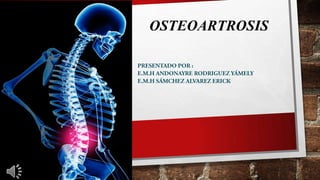 OSTEOARTROSIS

 