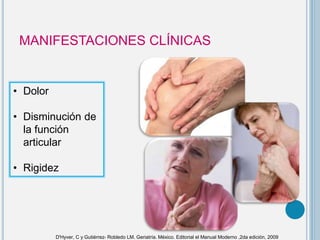 MANIFESTACIONES CLÍNICAS
• Dolor
• Disminución de
la función
articular
• Rigidez
D'Hyver, C y Gutiérrez- Robledo LM. Geriatría. México. Editorial el Manual Moderno ,2da edición, 2009
 