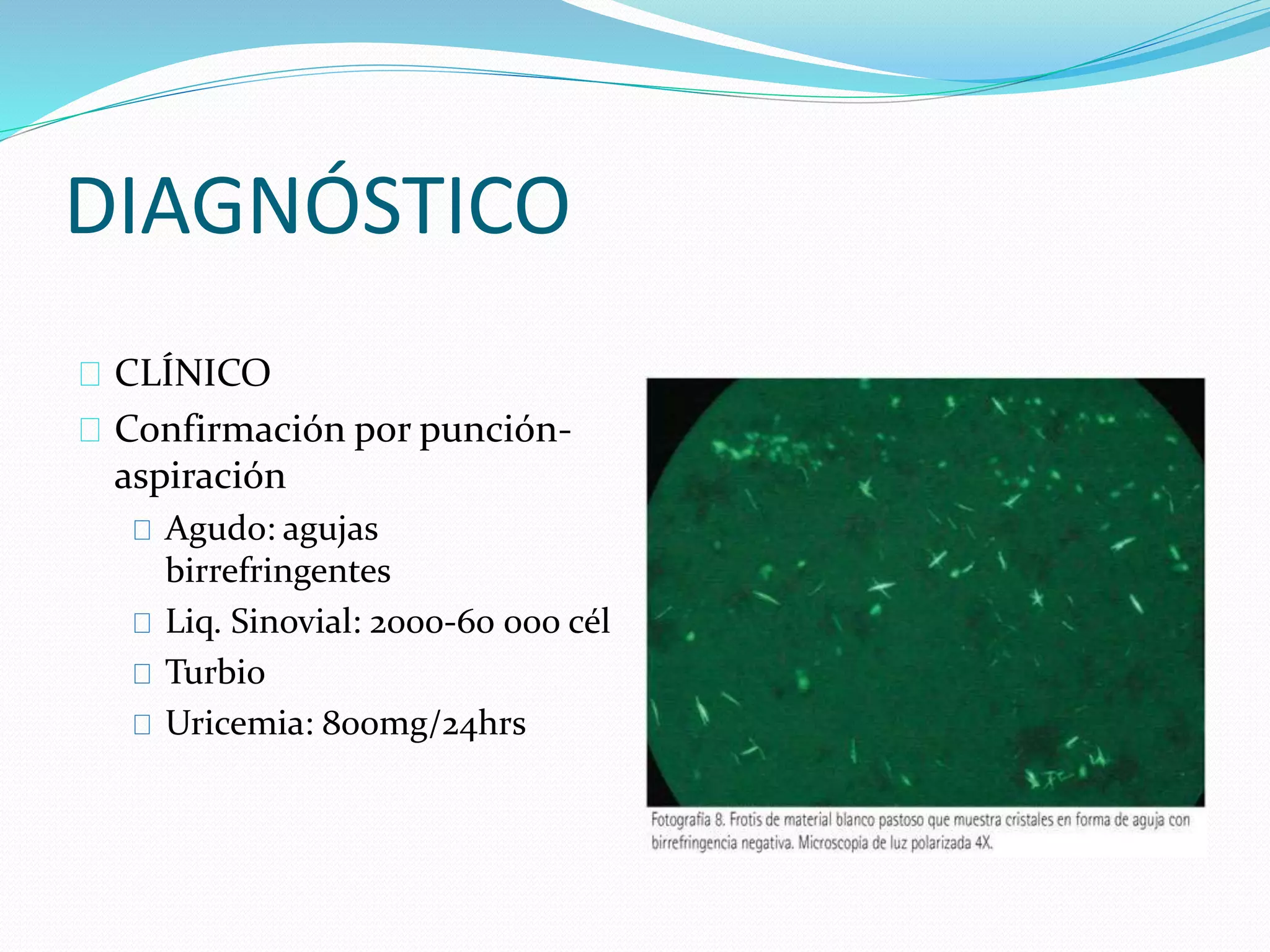 DIAGNÓSTICO
CLÍNICO
Confirmación por punción-
aspiración
Agudo: agujas
birrefringentes
Liq. Sinovial: 2000-60 000 cél
Turbio
Uricemia: 800mg/24hrs
 