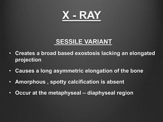 X - RAY
SESSILE VARIANT
• Creates a broad based exostosis lacking an elongated
projection
• Causes a long asymmetric elongation of the bone
• Amorphous , spotty calcification is absent
• Occur at the metaphyseal – diaphyseal region
 
