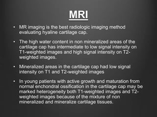 MRI
• MR imaging is the best radiologic imaging method
evaluating hyaline cartilage cap.
• The high water content in non mineralized areas of the
cartilage cap has intermediate to low signal intensity on
T1-weighted images and high signal intensity on T2-
weighted images.
• Mineralized areas in the cartilage cap had low signal
intensity on T1 and T2-weighted images
• In young patients with active growth and maturation from
normal enchondral ossification in the cartilage cap may be
marked heterogeneity both T1-weighted images and T2-
weighted images because of the mixture of non
mineralized and mineralize cartilage tissues.
 