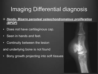 Imaging Differential diagnosis
Hands- Bizarre parosteal osteochondromatous proliferation
(BPOP)
• Does not have cartilaginous cap.
• Seen in hands and feet.
• Continuity between the lesion
and underlying bone is not found
• Bony growth projecting into soft tissues .
 
