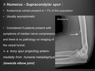 Humerus - Supracondylar spur :
• Anatomical variant present in ~1% of the population
• Usually asymptomatic
• Considered if patients present with
symptoms of median nerve compression
and there is no pathology on imaging of
the carpal tunnel.
 a bony spur projecting antero-
medially from humeral metadiaphysis
(towards elbow joint)
 