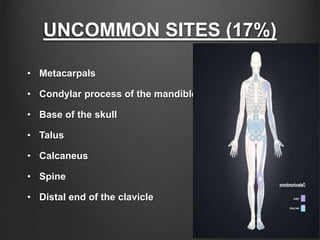 UNCOMMON SITES (17%)
• Metacarpals
• Condylar process of the mandible
• Base of the skull
• Talus
• Calcaneus
• Spine
• Distal end of the clavicle
 