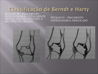 ESTÁGIO III – FRAGMENTO
OSTEOCONDRAL TOTALMENTE
DESTACADO EM CONTADO A
SEU SÍTIO DE ORIGEM
ESTÁGIO IV – FRAGMENTO
OSTEOCONDRAL DESLOCADO
 