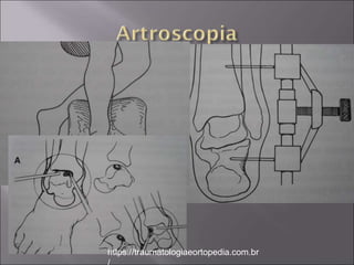 https://traumatologiaeortopedia.com.br
 