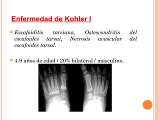 Enfermedad de Kohler I
   Escafoiditis    tarsiana, Osteocondritis        del
    escafoides tarsal, Necrosis avascular           del
    escafoides tarsal.

   4-9 años de edad / 20% bilateral / masculino.
 