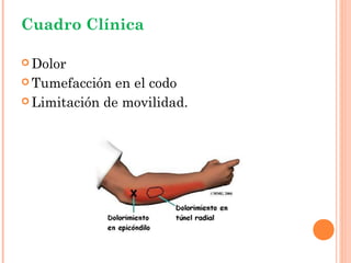 Cuadro Clínica

 Dolor

 Tumefacción  en el codo
 Limitación de movilidad.
 