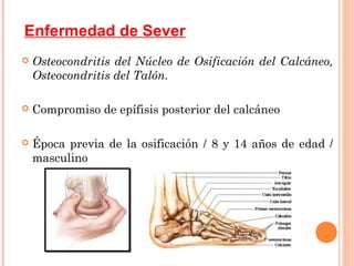 Enfermedad de Sever
   Osteocondritis del Núcleo de Osificación del Calcáneo,
    Osteocondritis del Talón.

   Compromiso de epífisis posterior del calcáneo

   Época previa de la osificación / 8 y 14 años de edad /
    masculino
 