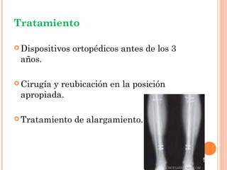 Tratamiento

 Dispositivos   ortopédicos antes de los 3
 años.

 Cirugía
        y reubicación en la posición
 apropiada.

 Tratamiento    de alargamiento.
 