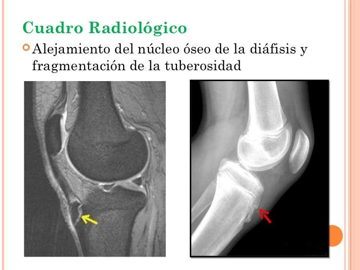 El dolor en el vientre que da en la espalda de la causa