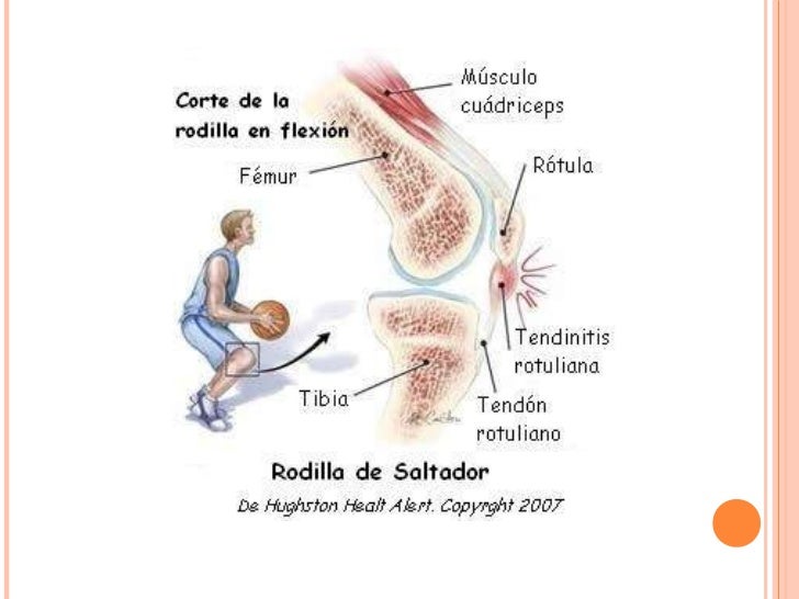 El dolor en el músculo de la espalda a la izquierda
