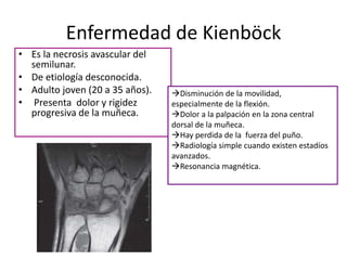 Enfermedad de Kienböck
• Es la necrosis avascular del
  semilunar.
• De etiología desconocida.
• Adulto joven (20 a 35 años).   Disminución de la movilidad,
• Presenta dolor y rigidez       especialmente de la flexión.
  progresiva de la muñeca.       Dolor a la palpación en la zona central
                                 dorsal de la muñeca.
                                 Hay perdida de la fuerza del puño.
                                 Radiología simple cuando existen estadíos
                                 avanzados.
                                 Resonancia magnética.
 