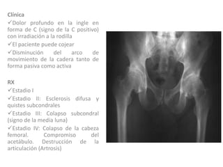 Clínica
Dolor profundo en la ingle en
forma de C (signo de la C positivo)
con irradiación a la rodilla
El paciente puede cojear
Disminución        del     arco de
movimiento de la cadera tanto de
forma pasiva como activa

RX
Estadio I
Estadio II: Esclerosis difusa y
quistes subcondrales
Estadio III: Colapso subcondral
(signo de la media luna)
Estadio IV: Colapso de la cabeza
femoral.       Compromiso     del
acetábulo. Destrucción de la
articulación (Artrosis)
 
