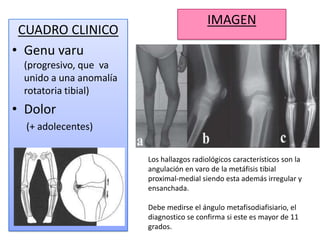 IMAGEN
 CUADRO CLINICO
• Genu varu
 (progresivo, que va
 unido a una anomalía
 rotatoria tibial)
• Dolor
  (+ adolecentes)


                        Los hallazgos radiológicos característicos son la
                        angulación en varo de la metáfisis tibial
                        proximal-medial siendo esta además irregular y
                        ensanchada.

                        Debe medirse el ángulo metafisodiafisiario, el
                        diagnostico se confirma si este es mayor de 11
                        grados.
 
