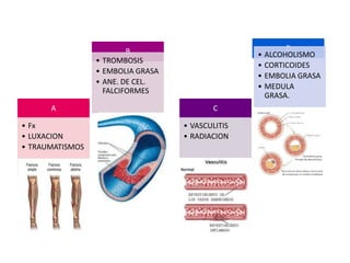 B                               D
                                                  • ALCOHOLISMO
                 • TROMBOSIS
                                                  • CORTICOIDES
                 • EMBOLIA GRASA
                                                  • EMBOLIA GRASA
                 • ANE. DE CEL.
                                                  • MEDULA
                   FALCIFORMES
                                                    GRASA.
      A                                   C

• Fx                               • VASCULITIS
• LUXACION                         • RADIACION
• TRAUMATISMOS
 