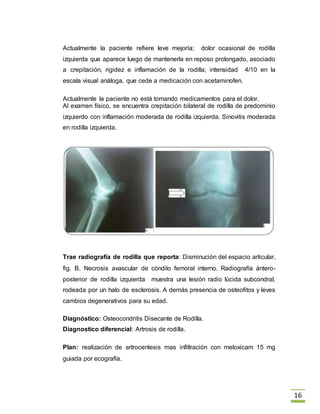 16
Actualmente la paciente refiere leve mejoría; dolor ocasional de rodilla
izquierda que aparece luego de mantenerla en reposo prolongado, asociado
a crepitación, rigidez e inflamación de la rodilla; intensidad 4/10 en la
escala visual análoga, que cede a medicación con acetaminofen.
Actualmente la paciente no está tomando medicamentos para el dolor.
Al examen físico, se encuentra crepitación bilateral de rodilla de predominio
izquierdo con inflamación moderada de rodilla izquierda. Sinovitis moderada
en rodilla izquierda.
Trae radiografía de rodilla que reporta: Disminución del espacio articular,
fig. B, Necrosis avascular de cóndilo femoral interno. Radiografía ántero-
posterior de rodilla izquierda muestra una lesión radio lúcida subcondral,
rodeada por un halo de esclerosis. A demás presencia de osteofitos y leves
cambios degenerativos para su edad.
Diagnóstico: Osteocondritis Disecante de Rodilla.
Diagnostico diferencial: Artrosis de rodilla.
Plan: realización de artrocentesis mas infiltración con meloxicam 15 mg
guiada por ecografía.
 