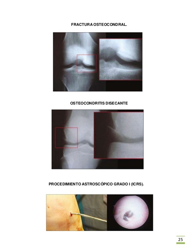 Los tratamientos de las hernias intervertebrales en arhangelske