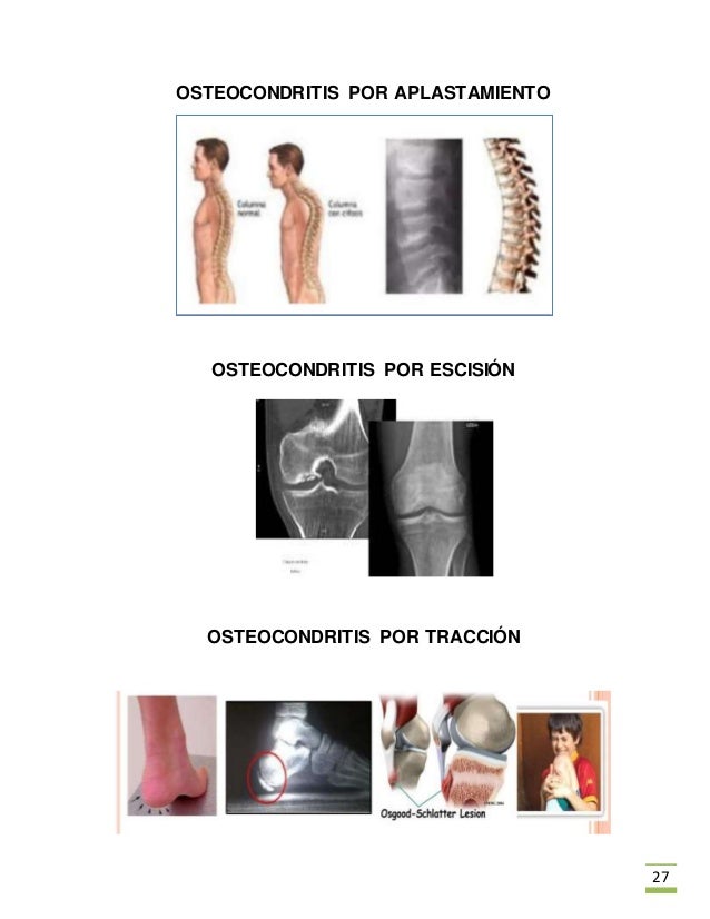 Que anestesian para la columna vertebral el dolor el departamento de pecho