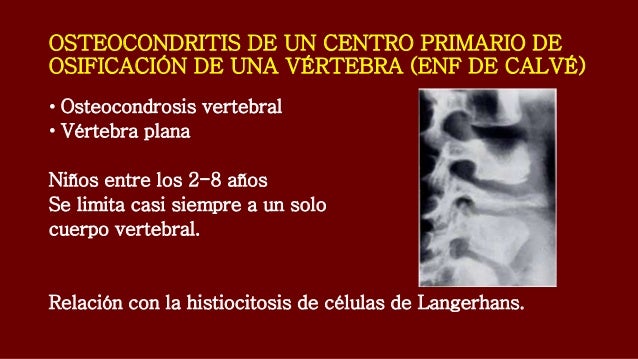 Que puede dar la osteocondrosis del tórax
