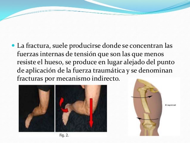 Por qué duele la espalda abajo que hacer