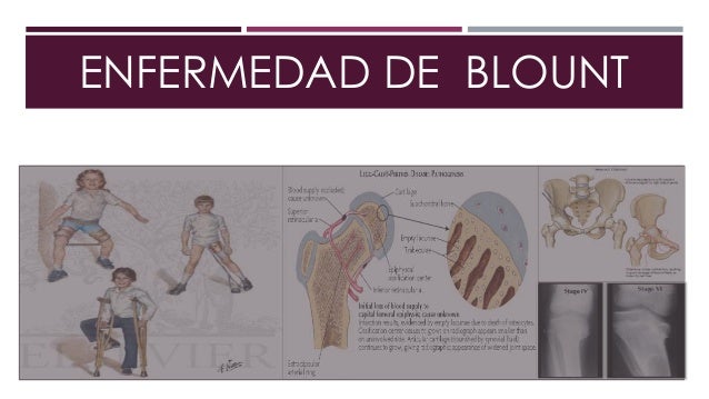 Que hacer al dolor de cabeza a sheynom la osteocondrosis
