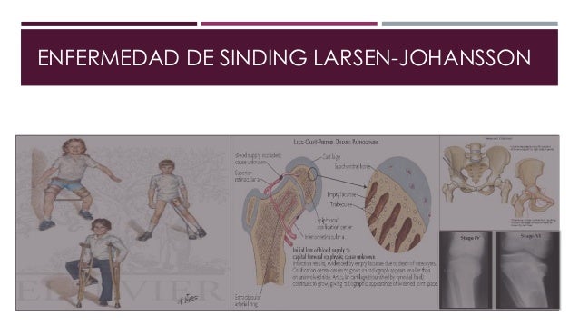 Al suspiro duele la espalda a la derecha bajo la espátula