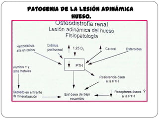 Patogenia de la lesión adinámica
hueso.

 