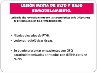 Lesión mixta de alto y bajo
remodelamiento.
Lesión de alto remodelamiento con las caracteristicas de la OFQ y áreas
de osteomalacia con bajo remodelamiento.

 Niveles elevados de PTHi.
 Lesiones radiológicas óseas.
 Se puede presentar en pacientes con OFQ

paratiroidetomizados o tratados con diálisis ricas en
calcio.

 