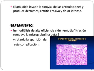  El amiloide invade la sinovial de las articulaciones y

produce derrames, artritis erosiva y dolor intenso.

Tratamiento:
 hemodiálisis de alta eficiencia y de hemodiafiltración
remueve la microglobulina beta 2
y retarda la aparición de
esta complicación.

 
