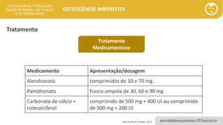 portaldeboaspraticas.iff.fiocruz.br
OSTEOGÊNESE IMPERFEITA
Tratamento
Medicamentoso
Medicamento Apresentação/dosagem
Alendronato comprimidos de 10 e 70 mg.
Pamidronato frasco-ampola de 30, 60 e 90 mg
Carbonato de cálcio +
colecalciferol
comprimido de 500 mg + 400 UI ou comprimido
de 500 mg + 200 UI
Ministério da Saúde, 2013.
Tratamento
 