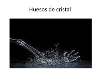 Huesos de cristal

 