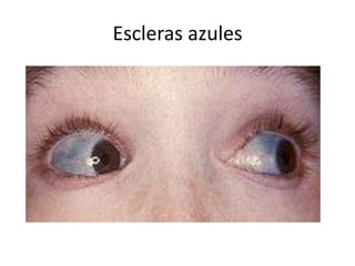 Escleras azules

 