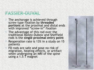  The anchorage is achieved through
screw type fixation by threaded
portions at the proximal and distal ends
with improved “screw-in” fixation
 The advantage of this rod over the
traditional Bailey-Dubow and Sheffield
rods is the single proximal entry point
 Reoperation rate is 13% in a study on 15
patients
 FD rods are safe and pose no risk of
migration, heating effects, or artifact
when undergoing an MRI of the spine
using a 1.5 T magnet
 