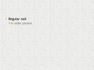  Regular nail
 In older patient
 