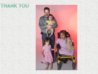 Osteogenesis imperfecta