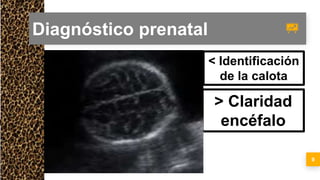 Osteogenesis imperfecta fetal | PPT