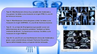 • Tipo IX: Manifestación clínica muy variable (de moderada a
muy grave). Se debe a una mutación en el gen PPIB. Es una OI
de herencia recesiva.
• Tipo X: Manifestación clínica de grave a letal. Se debe a una
mutación en el gen SERPINH1. Es una OI de herencia recesiva.
• Tipo XI : Es un tipo de OI progresivo que puede cursar con
deformaciones de la columna vertebral. También se llama
síndrome de Bruck I. Su herencia es recesiva. Se debe a una
mutación en el gen FKBP10.
• Tipo XII: Es una OI con una manifestación clínica de moderada a
grave, cuyas características incluyen fracturas frecuentes,
ligeras deformidades óseas y erupción dental retrasada.
 